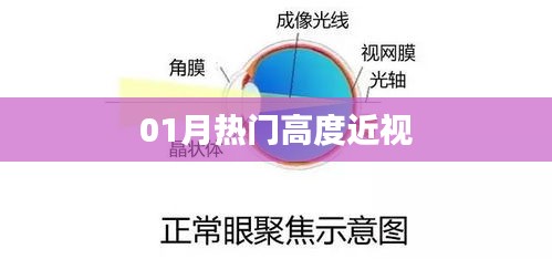 热门高度近视资讯，一月份深度解析