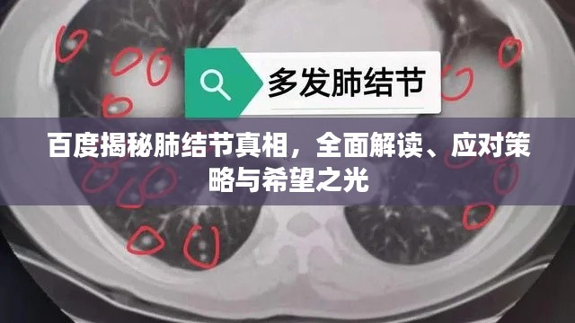 百度揭秘肺结节真相，全面解读、应对策略与希望之光
