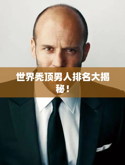 世界秃顶男人排名大揭秘！